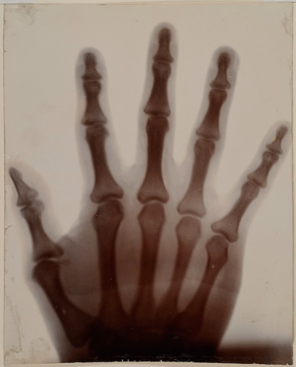Unknown photographer, Hand, c. 1920s–1930s, X-ray, selenium-toned gelatin silver print, 7-1/2 x 6 inches. Palmer Museum of Art, Gift of Jon Randall Plummer, 2012.92
